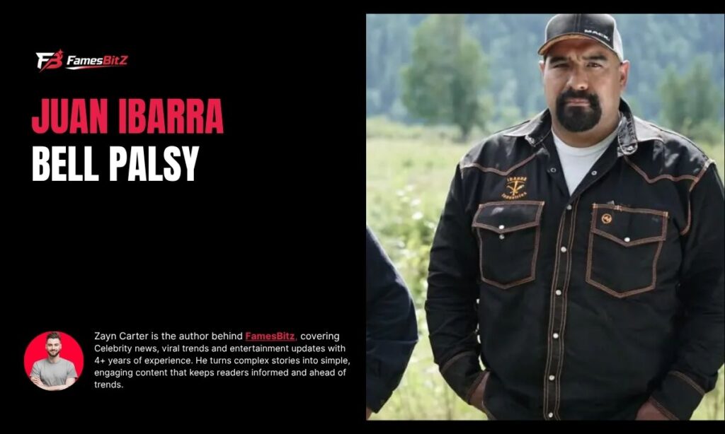 Juan Ibarra Bell Palsy